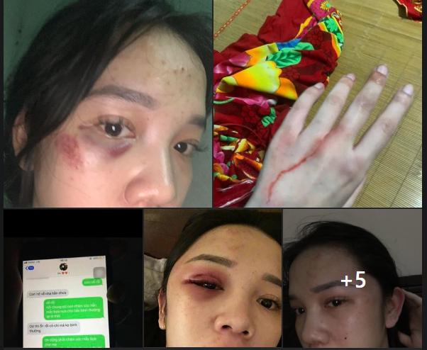 Làm bạn gái có bầu, thanh niên và mẹ rủ nhau lên kế hoạch xử lý-4