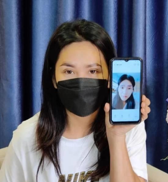 Có tới hai cặp lông mày sau khi đi thẩm mỹ rẻ tiền-2