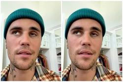 Justin Bieber hủy lưu diễn vòng quanh thế giới vì lo ngại sức khỏe