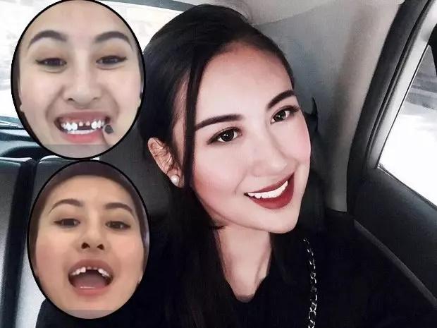 Trang Nemo xuất hiện với hàm răng kỳ lạ, cái còn cái mất-8