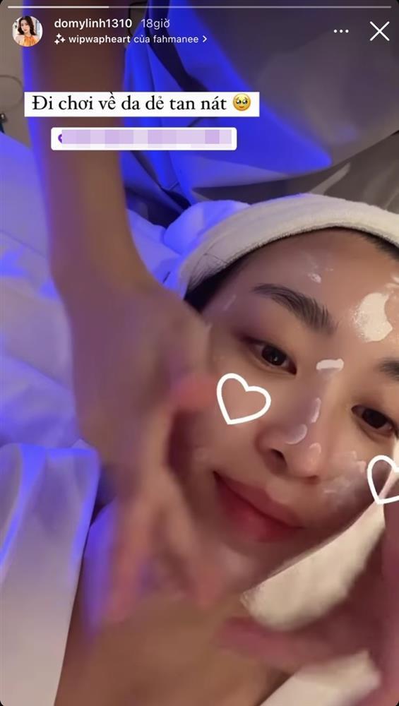 Đỗ Mỹ Linh da dẻ tan nát sau chuyến châu Âu với tình tin đồn-1