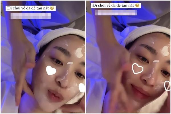 Đỗ Mỹ Linh da dẻ tan nát sau chuyến châu Âu với tình tin đồn-2