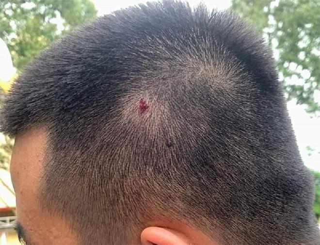 Thầy giáo viết tâm thư sau khi dùng mũ bảo hiểm đánh 2 nam sinh-3