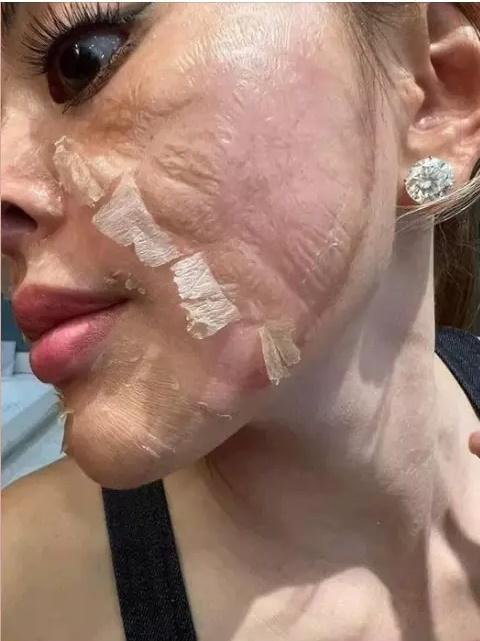 Trang Nemo nói chuyện rớt cả răng, chồng phản ứng phũ-7