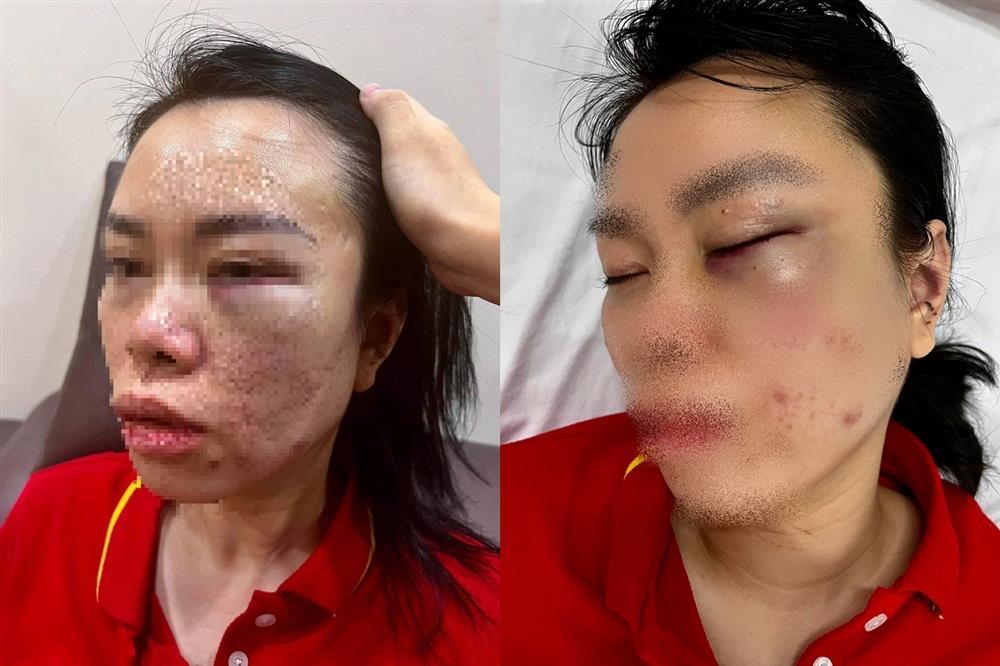 Người phụ nữ bị chồng cũ bắt giữ, đánh đập dã man suốt 1 ngày-1