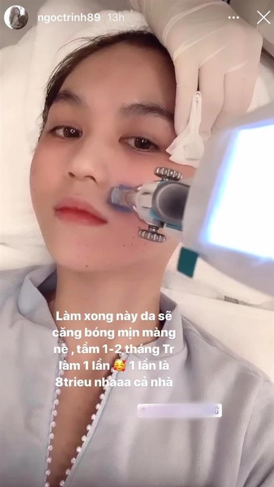 Dấu hiệu tuổi tác của Ngọc Trinh khi tuổi 33 cận kề-12