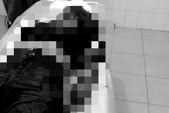 Người chồng chém đứt lìa 2 tay vợ có thể bị xử lý thế nào?