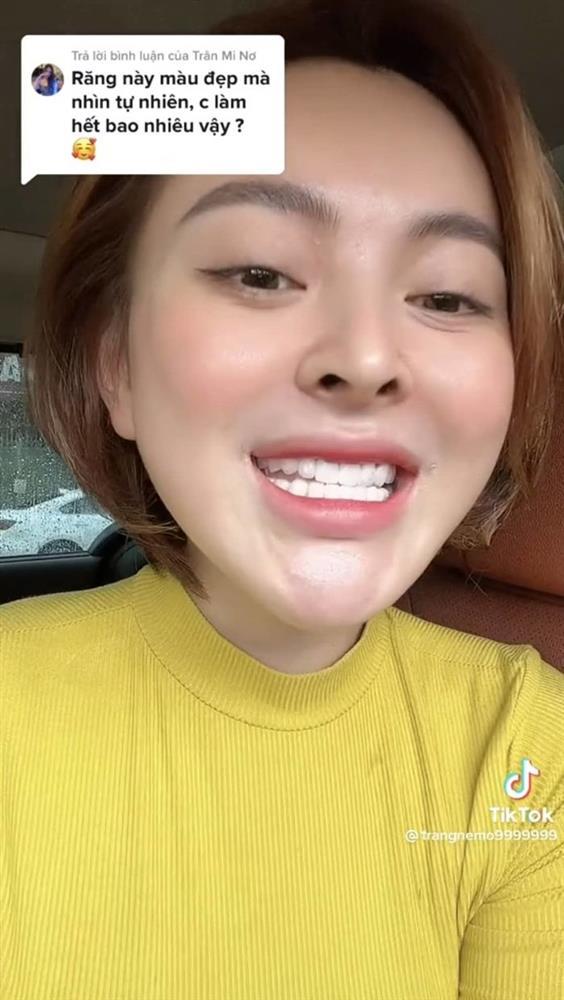 Trang Nemo chơi lớn, chi tiền làm răng bằng xây cả căn nhà-3