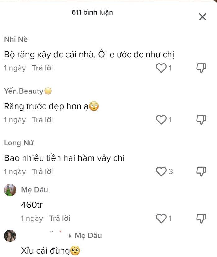 Trang Nemo chơi lớn, chi tiền làm răng bằng xây cả căn nhà-5