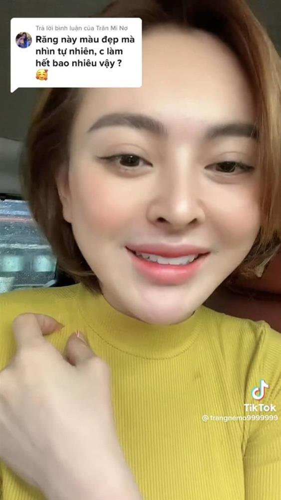 Trang Nemo chơi lớn, chi tiền làm răng bằng xây cả căn nhà-4