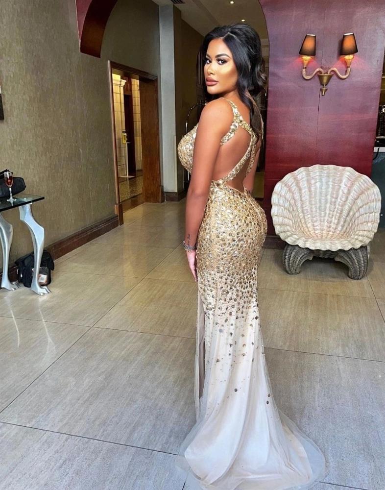 Đau đớn vì phẫu thuật độn vòng ba giống Kim Kardashian-1