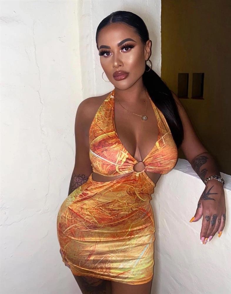 Đau đớn vì phẫu thuật độn vòng ba giống Kim Kardashian-2