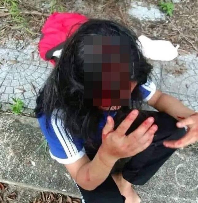 Không mua nước gúp bạn, nữ sinh lớp 8 ở Huế bị đánh chảy máu đầu-1