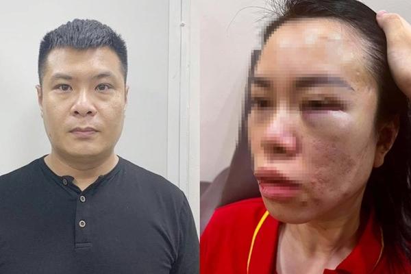 Một hoa hậu tố bị đánh chảy máu đầu tại công an phường-3