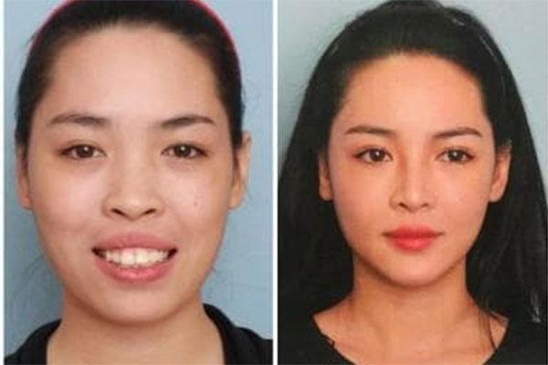 Bỏ tiền làm lông mày, người phụ nữ nhận về 2 con sâu róm trên mặt-10