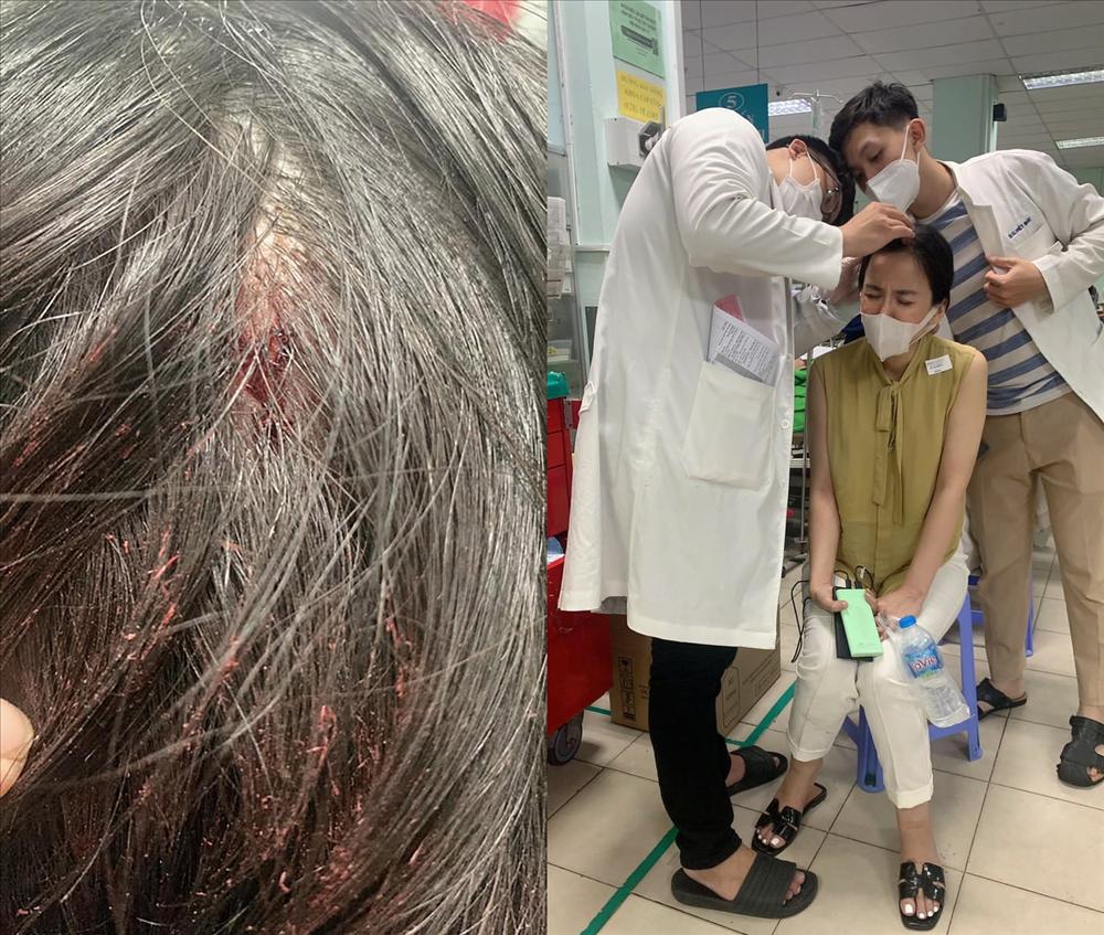 Hoa hậu tố bị đánh tại công an phường: Có dấu hiệu khai báo gian dối-2