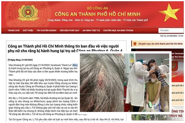 Hoa hậu tố bị hành hung nói gì về nghi vấn vu khống?-4