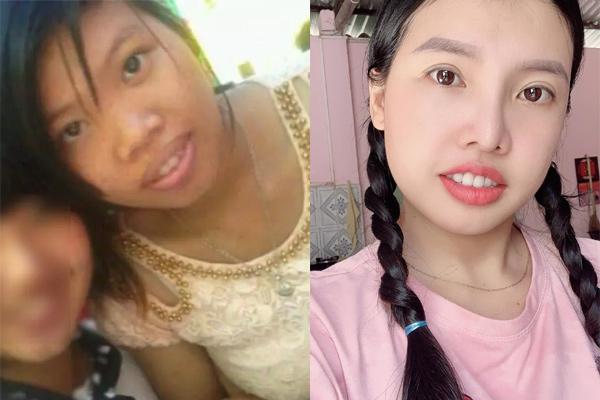 Thị Nở tái sinh Quách Phượng nhan sắc ra sao sau 6 năm dao kéo?-7