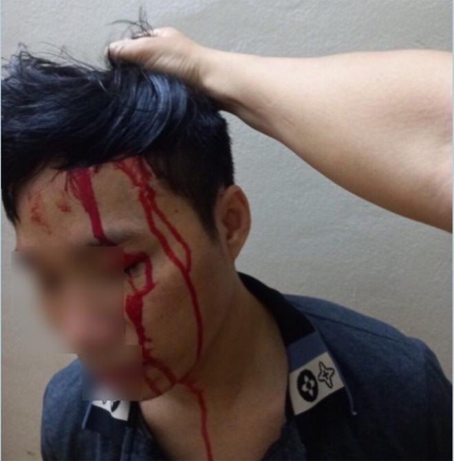 Mua tiết lợn về, rủ người yêu dựng kịch bản bị bắt cóc để tống tiền mẹ đẻ-2