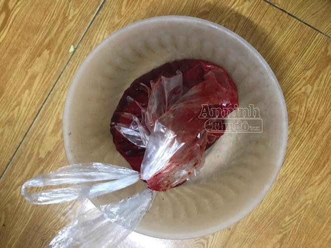 Mua tiết lợn về, rủ người yêu dựng kịch bản bị bắt cóc để tống tiền mẹ đẻ-3