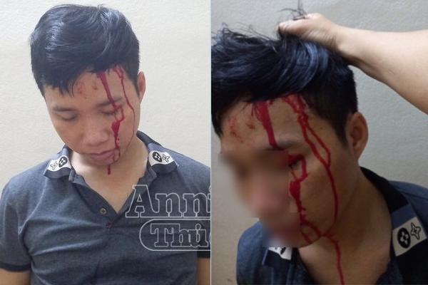 Bắt antifan tống tiền các diễn viên, ca sĩ, người nổi tiếng-2