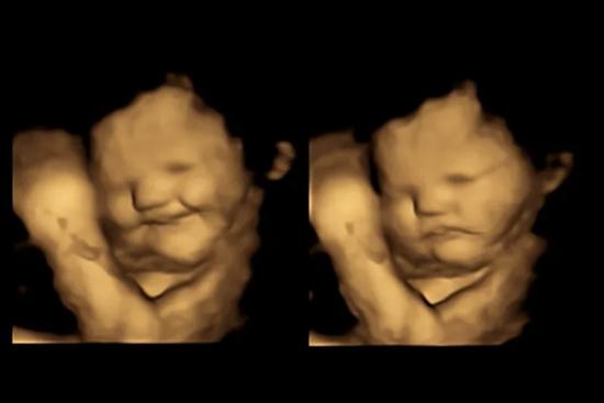 Thai nhi biểu hiện cảm xúc khác nhau khi mẹ ăn cà rốt và cải xoăn