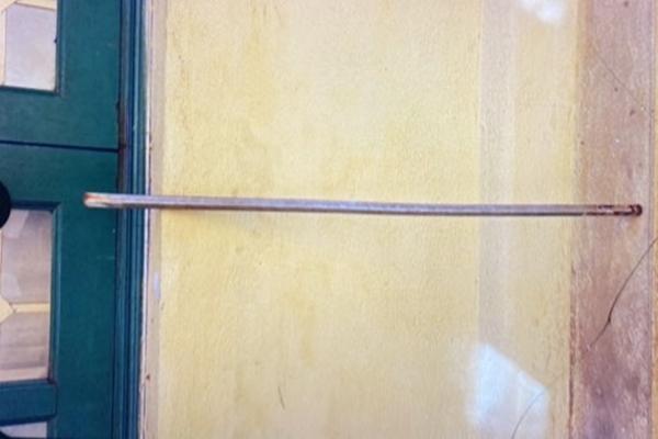 Bé trai bị thanh sắt đâm xuyên hậu môn từ trò đùa của bạn-1