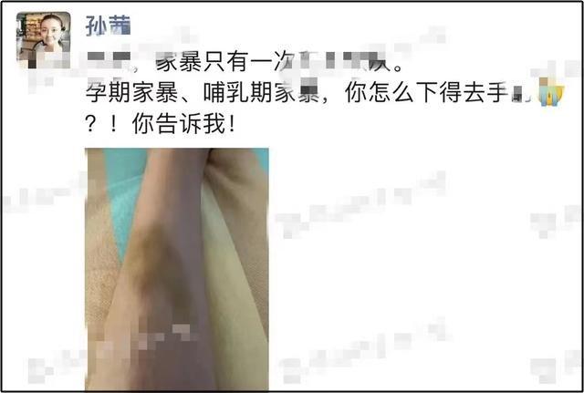 Người đẹp Chân Hoàn Truyện nghi bị chồng bạo hành-1