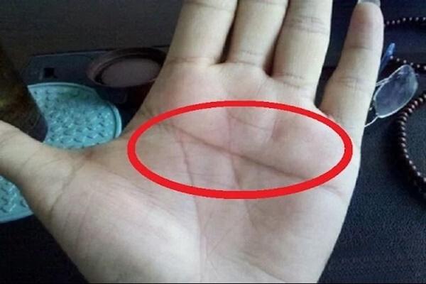 5 nốt ruồi báo hiệu phúc lộc, người sở hữu làm đâu thắng đó-2