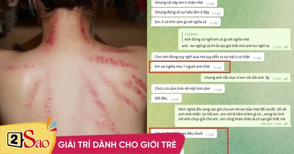 Bạn gái cởi áo cho anh kết nghĩa cạo gió, bạn trai hỏi câu hết hồn