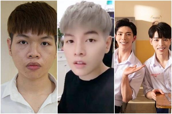 Trâm Anh gây hãi vì khoe cận cảnh tiêm mặt xóa rãnh cười-14