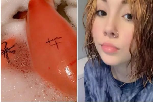 Hành khách bị từ chối bay chỉ vì mắc bệnh dị ứng hạt-3