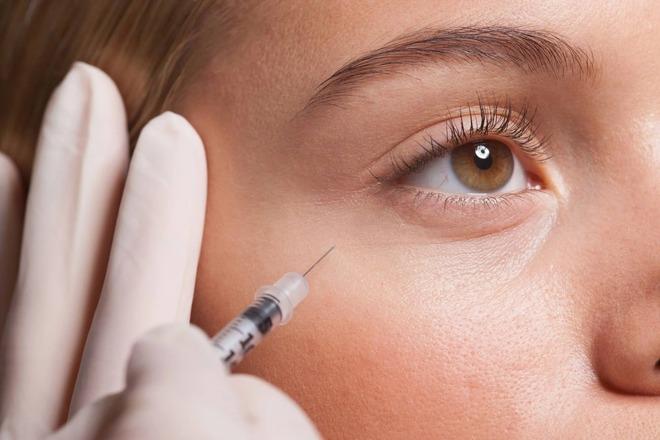 Tác hại tiềm ẩn khi 20 tuổi đã tiêm botox-2