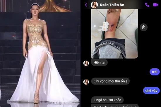 Miss Grand Vietnam Đoàn Thiên Ân toác chân vẫn catwalk đỉnh