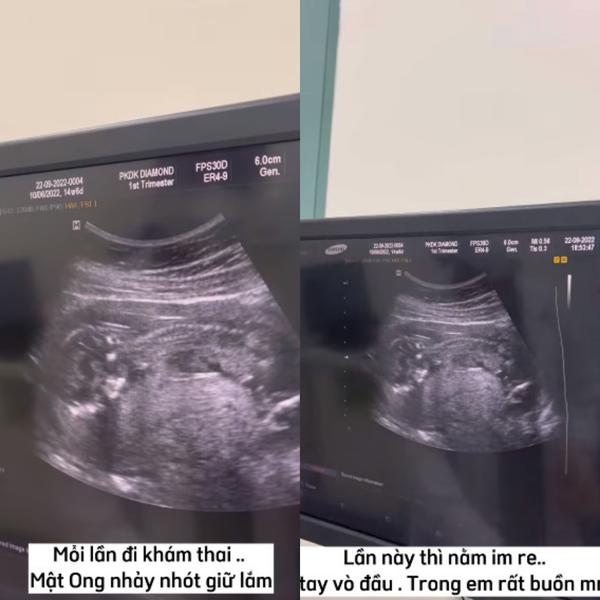 Chuẩn bị sinh con cho tomboy Bi Bảo, Múi Xù lộ ảnh khóc nức nở-3