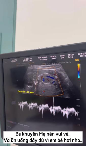 Chuẩn bị sinh con cho tomboy Bi Bảo, Múi Xù lộ ảnh khóc nức nở-4