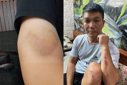 Nhiều người đi đường ở Hà Nội bị tấn công bằng vỏ chai