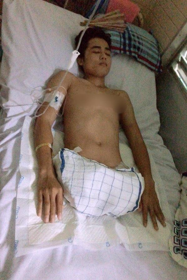 Tô Đình Khánh 2 lần mất đi đôi chân, vực dậy vì sợ bố mẹ buồn-5