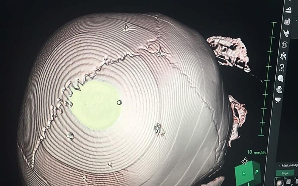 Kẻ đóng 10 cây đinh vào đầu bé gái 3 tuổi tử vong sắp hầu tòa-4