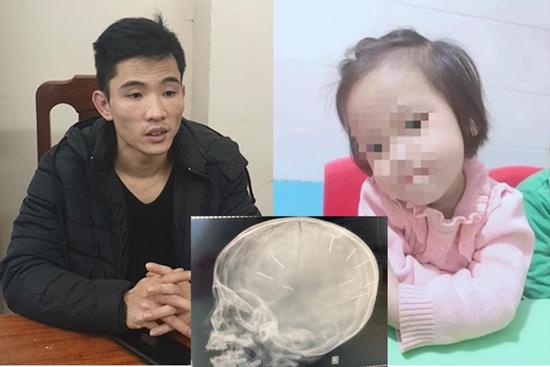 Kẻ đóng 10 cây đinh vào đầu bé gái 3 tuổi tử vong sắp hầu tòa
