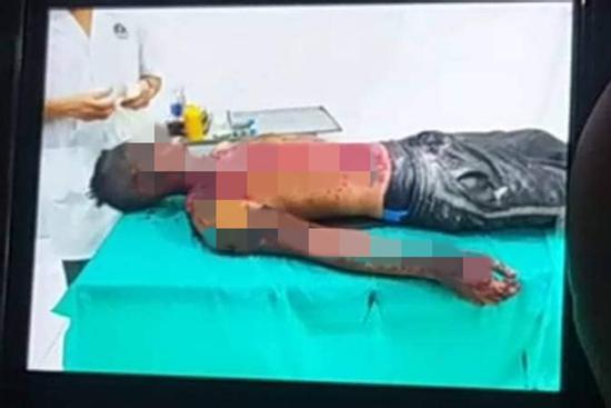 Nổ bình oxy kinh hoàng, thanh niên nguy kịch vì bỏng nặng