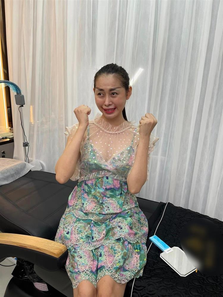 Hot Tiktok Việt Phương Thoa liên tục lộ mặt mụn, da đen nhẻm-5