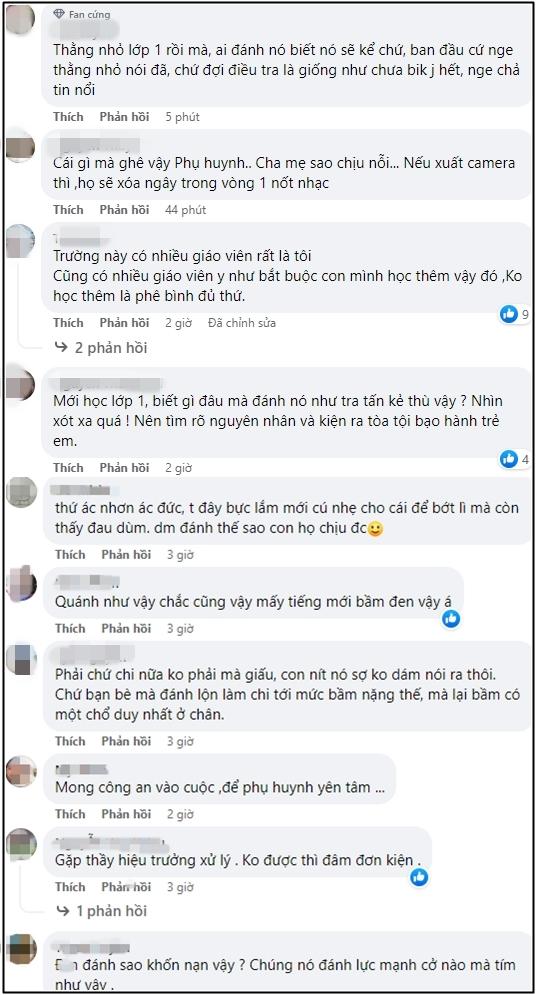 Xôn xao học sinh lớp 1 ở Đà Nẵng bị bầm tím tay chân sau buổi học-2