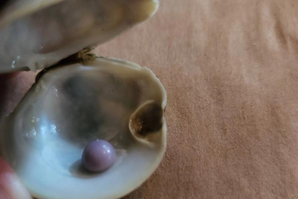 Đồ chơi dài 25cm kẹt trong trực tràng của nam thanh niên-2