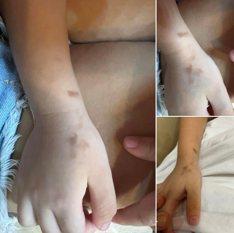 Hoàng Oanh lên mạng tìm trợ giúp khi da dẻ con trai có vấn đề-2