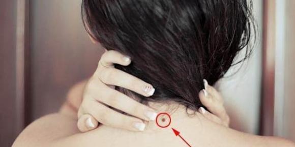 Người có 4 nốt ruồi này gặp nhiều may mắn sung túc-4