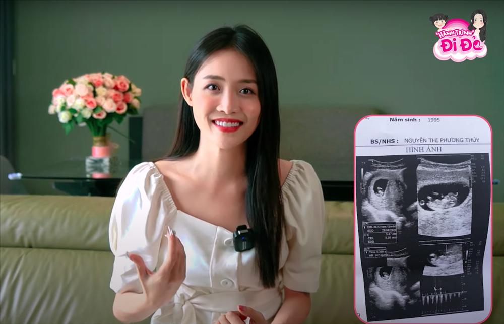 Trương Mỹ Nhân kể chuyện đi đẻ, mang bầu tăng đến 24kg-3