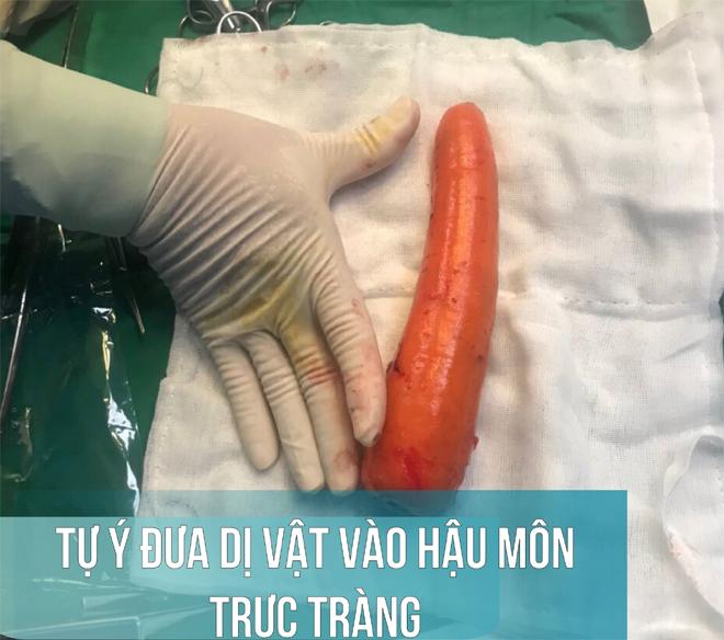 Thử cảm giác lạ, thiếu niên kẹt củ cà rốt 20cm trong hậu môn-1