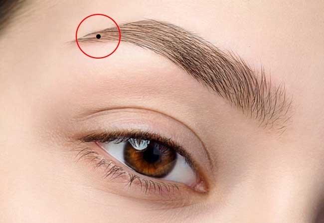 3 vị trí nốt ruồi phát tài, trung niên phát lộc không nên tẩy xóa-1