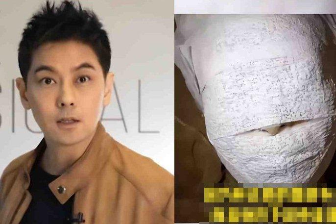 Lâm Chí Dĩnh lần đầu xuất hiện sau tai nạn xe hơi-3